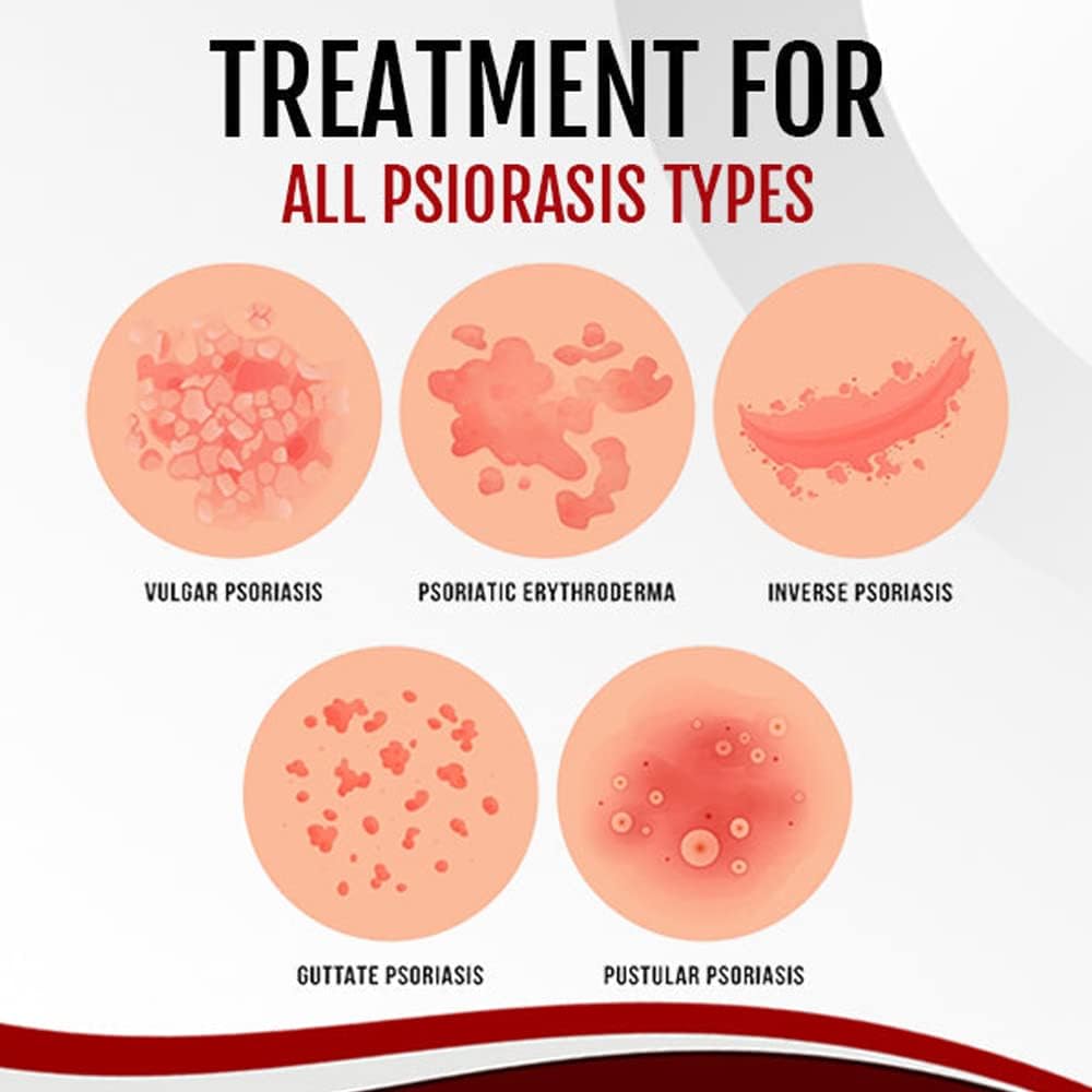 2x1 Spray Eliminación Psoriasis