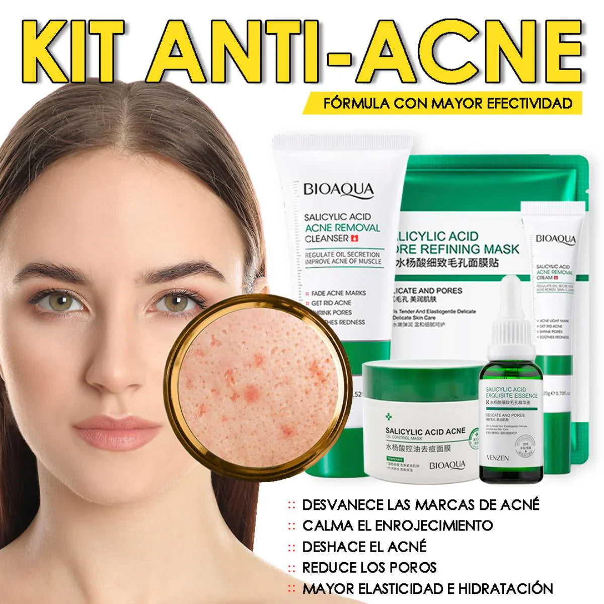 Combo X5  - Kit  Antiacné Ácido Salicílico