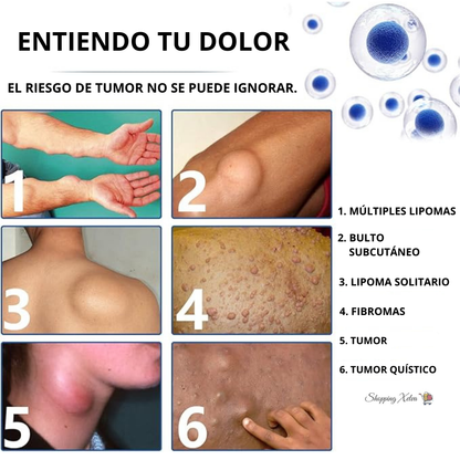 SPRAY  ELIMINACIÓN  LIPOMA 2x1