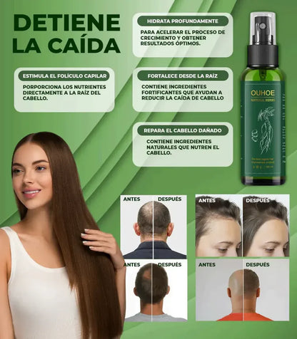 Spray Para Crecer El Pelo